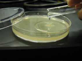 קוך פיתח שיטות לגידול תרבית חיידקים נקיה - 1881 תפוח אדמה ג'לטין אגר (הסה)