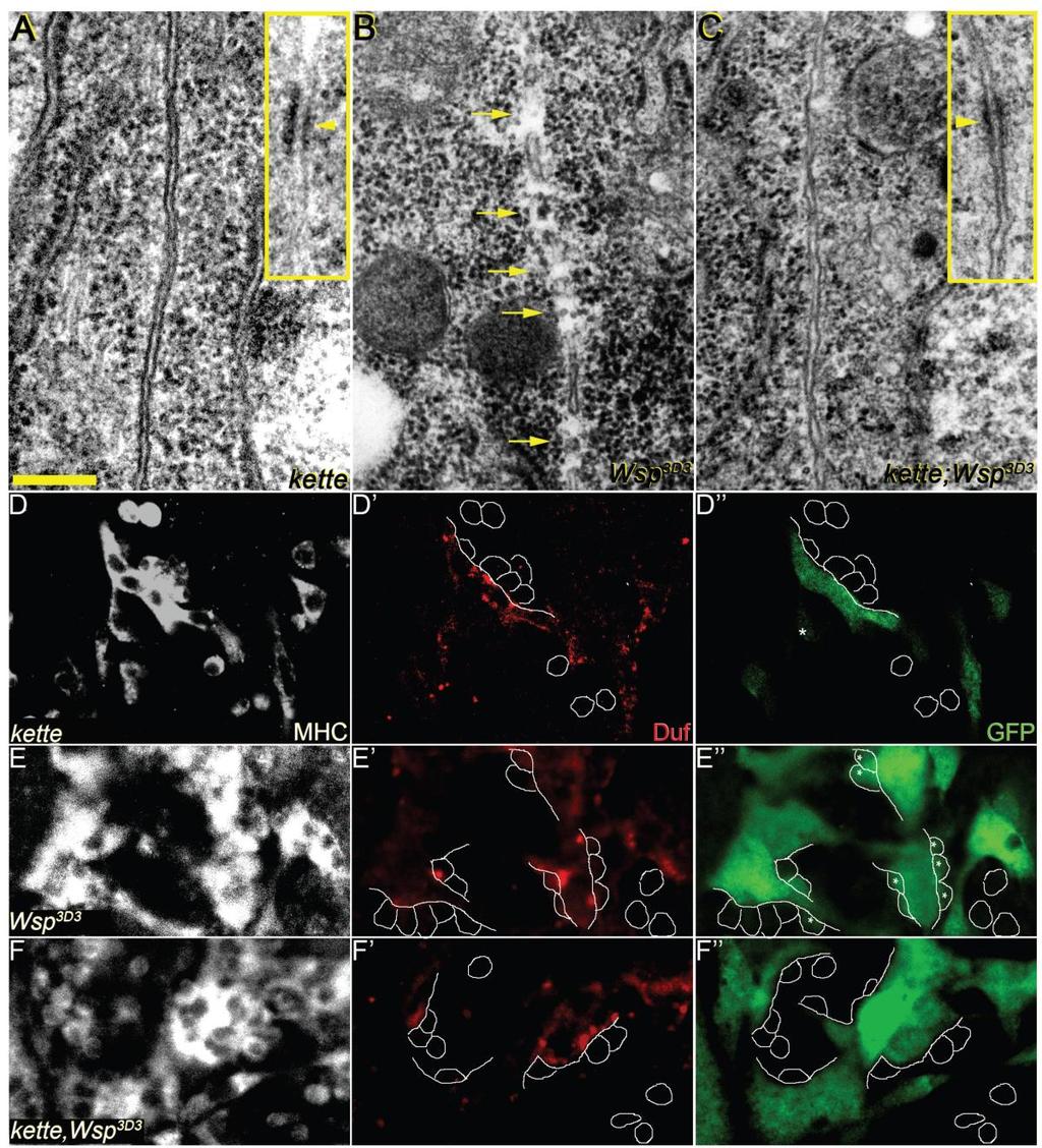 Figure 3. SCAR and Wsp pathway mutants arrest at distinct stages of the myoblast fusion process. (A-C) EM micrographs of attached pairs of myoblasts.