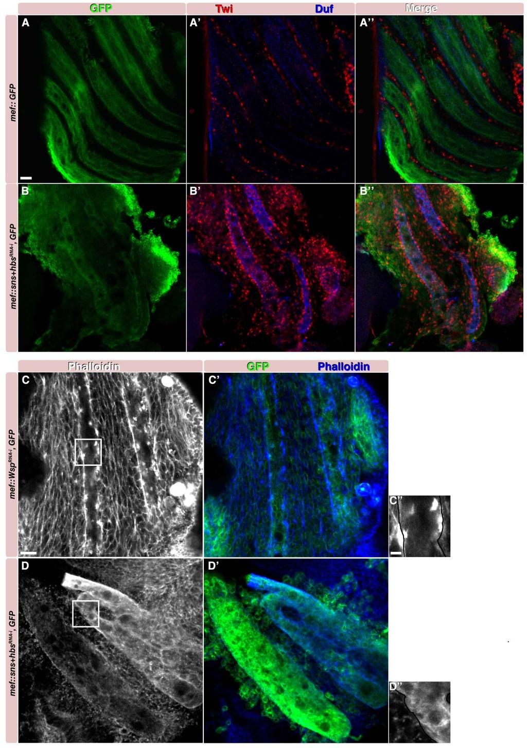 Figure 3. Sns and Hbs are required for myoblast fusion and formation of actin foci. [A-D] Dissected pupal muscles 18-22 hours APF.