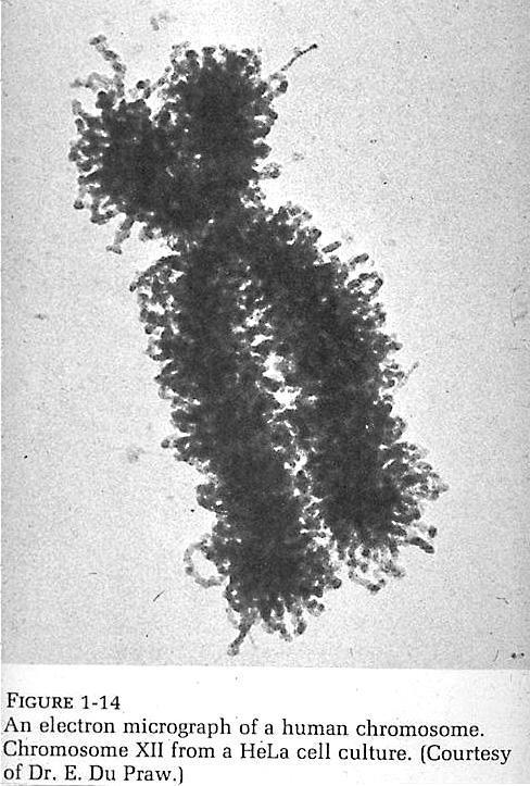 כרומוזום אנושי תמונה של כרומוזום 12 של אדם.