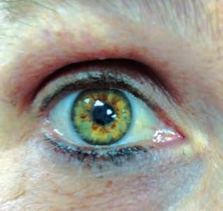 מאבחנים באירידולוגיה קלינית אירידולוגיה הינה שיטת אבחון עתיקה דרך קשתית העין )גלגל העין הצבעוני( המאפשרת זיהוי של חולשות מולדות ונרכשות של האדם.