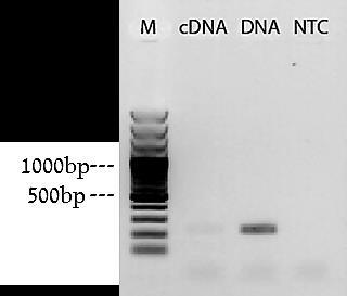 log הרצה על גבי ג'ל אגרוז 1.5%. איור 14: הפרדה על גבי ג'ל של תוצרי PCR לבדיקת נוכחות וביטוי חולף של הגן Cas9 בקאלוסים hcas יומיים לאחר ההפצצה.