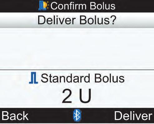 6 אספקת בולוס 6 5 בולוס סטנדרטי כדי לחזור למסך Bolus Advice )המלצת בולוס( לפני תחילת מתן הבולוס, בחר Back )הקודם(. כדי להתחיל באספקה מהמשאבה, בחר Deliver )ספק(.