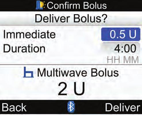6 בולוס משולב כדי לחזור למסך Bolus Advice )המלצת בולוס( לפני תחילת מתן הבולוס, בחר Back )הקודם(. כדי לשנות את כמות הבולוס המיידי, בחר את שדה ההזנה Immediate )מיידי( ולחץ על.