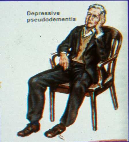 דיכאון