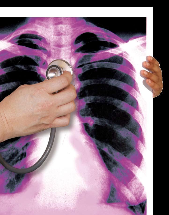 אלרגיה, אסתמה ומחלות דרכי הנשימה אתגרים