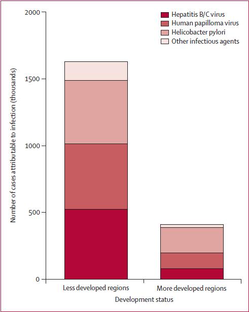 Figure 5. Number of new cancer cases in 2008 attributable to infection, by infectious agent and development status.