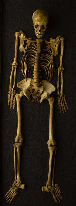 Wellcome Trust Collection and Exhibitions Skeleton of post-medieval female with foetus The skeleton of this pregnant young woman and her unborn child, estimated to have died between 1700 and