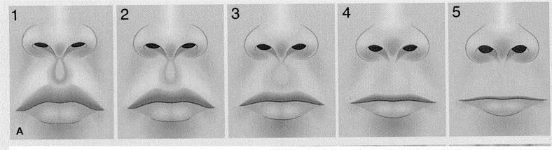 thinness of the upper lip are assessed