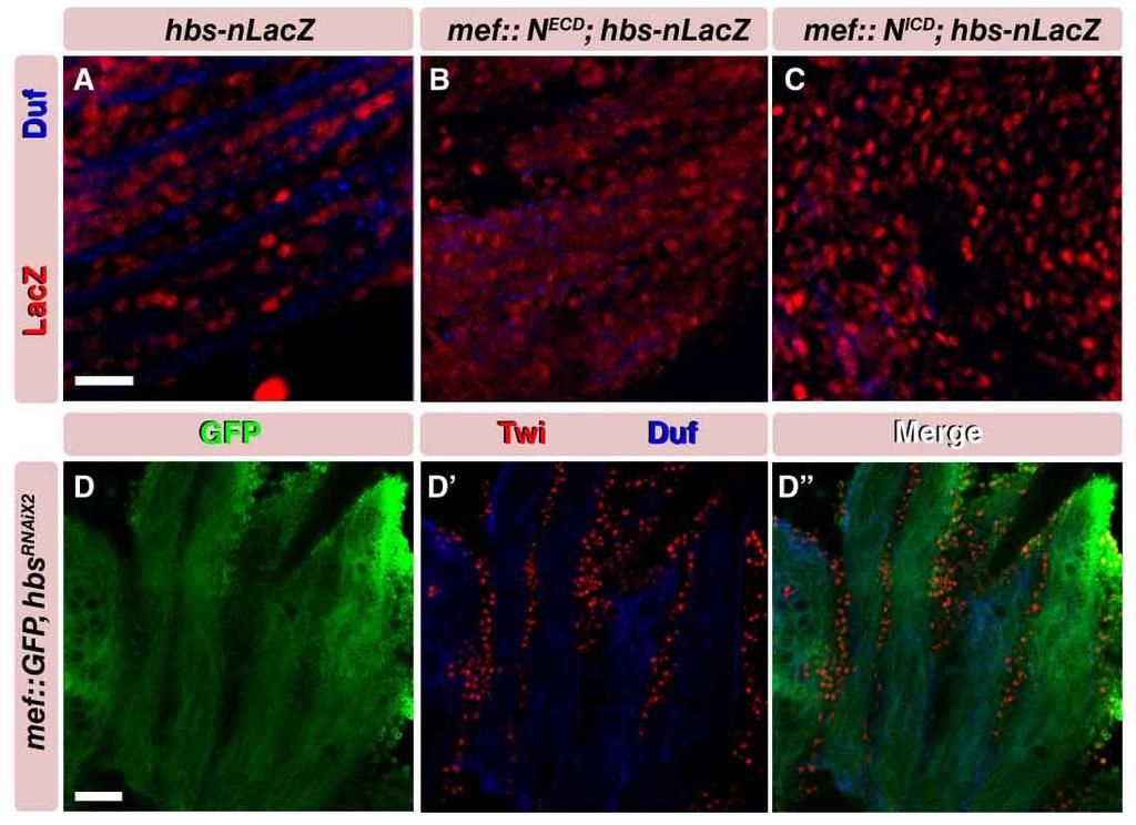 Supplementary 4. hibris is positively regulated by Notch signaling, but is not essential for myoblast migration. [A-D] Dissected pupal muscles 18-22 hours APF.