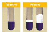 The medium inhibits most gram+ bacteria, gram- bacteria, yeast and saprophytic