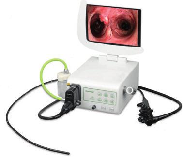 דיאגנוסטיקה אנדוסקופ גמיש EickView HD Video endoscope מערכת כוללת לאנדוסקופיה עם מעבד לעיבוד תמונה ותוכנה ייעודית לצילום ועריכה. ניתן לצלם סטילס וסירטוני וידאו.