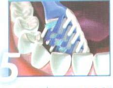 לצחצוח הצד הפנימי של השיניים האחוריות, יש להניע את המברשת בתנועות קצרות. 5.