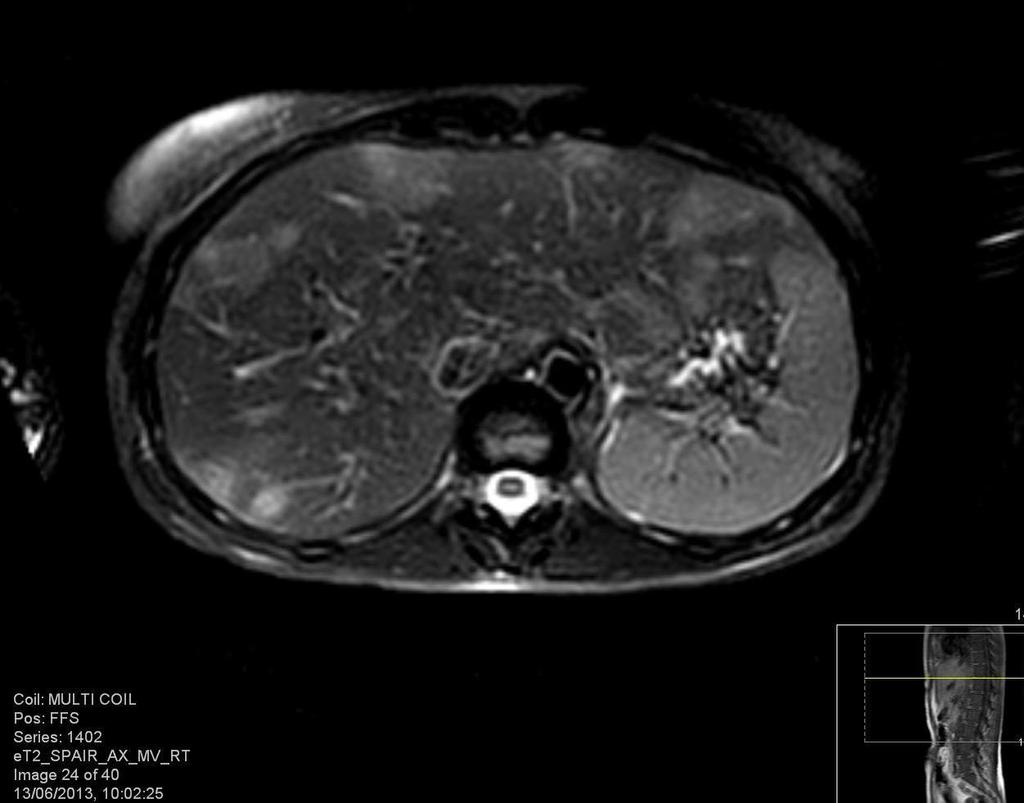 בטן MRI By radiologist Dr.
